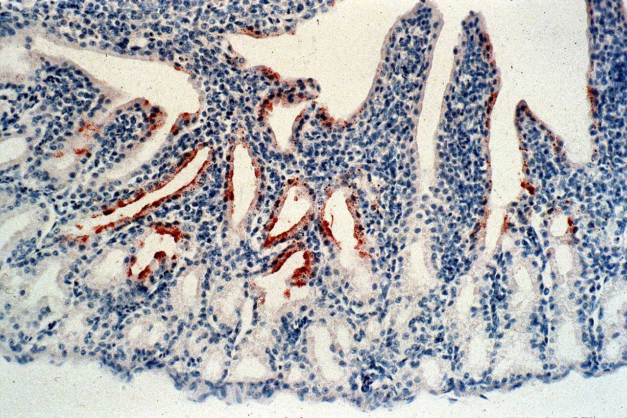 Newcastle Krankheit - Article 3